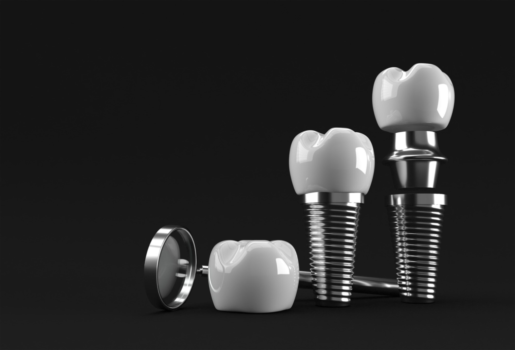 dental implants in turkey